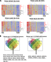 Glutathione peroxidase 2 is a metabolic driver of the tumor immune microenvironment and immune checkpoint inhibitor response