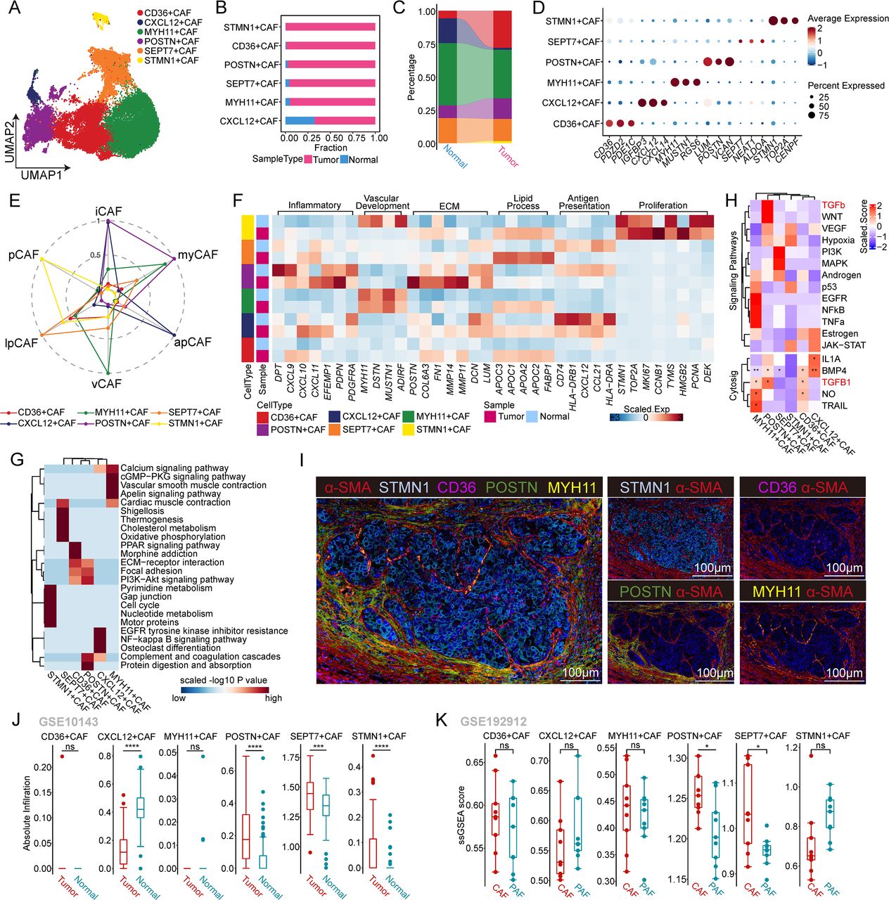 POSTN+ cancer-associated fibroblasts determine the efficacy of