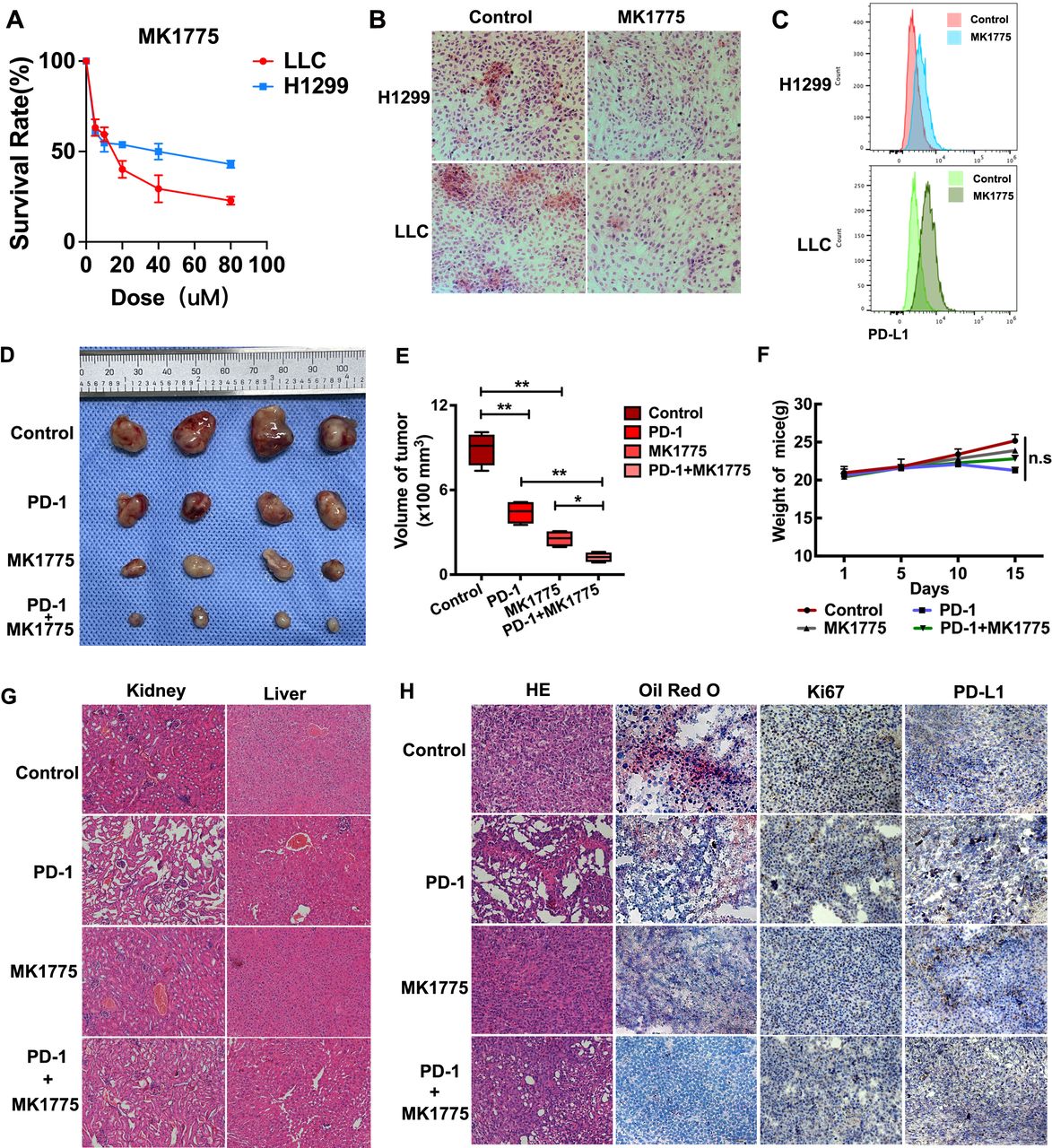 Harnessing lipid metabolism modulation for improved immunotherapy ...