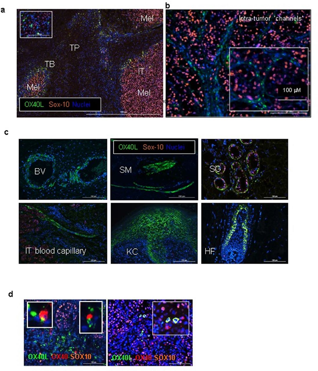 922 OX40L expression in the melanoma microenvironment – potential