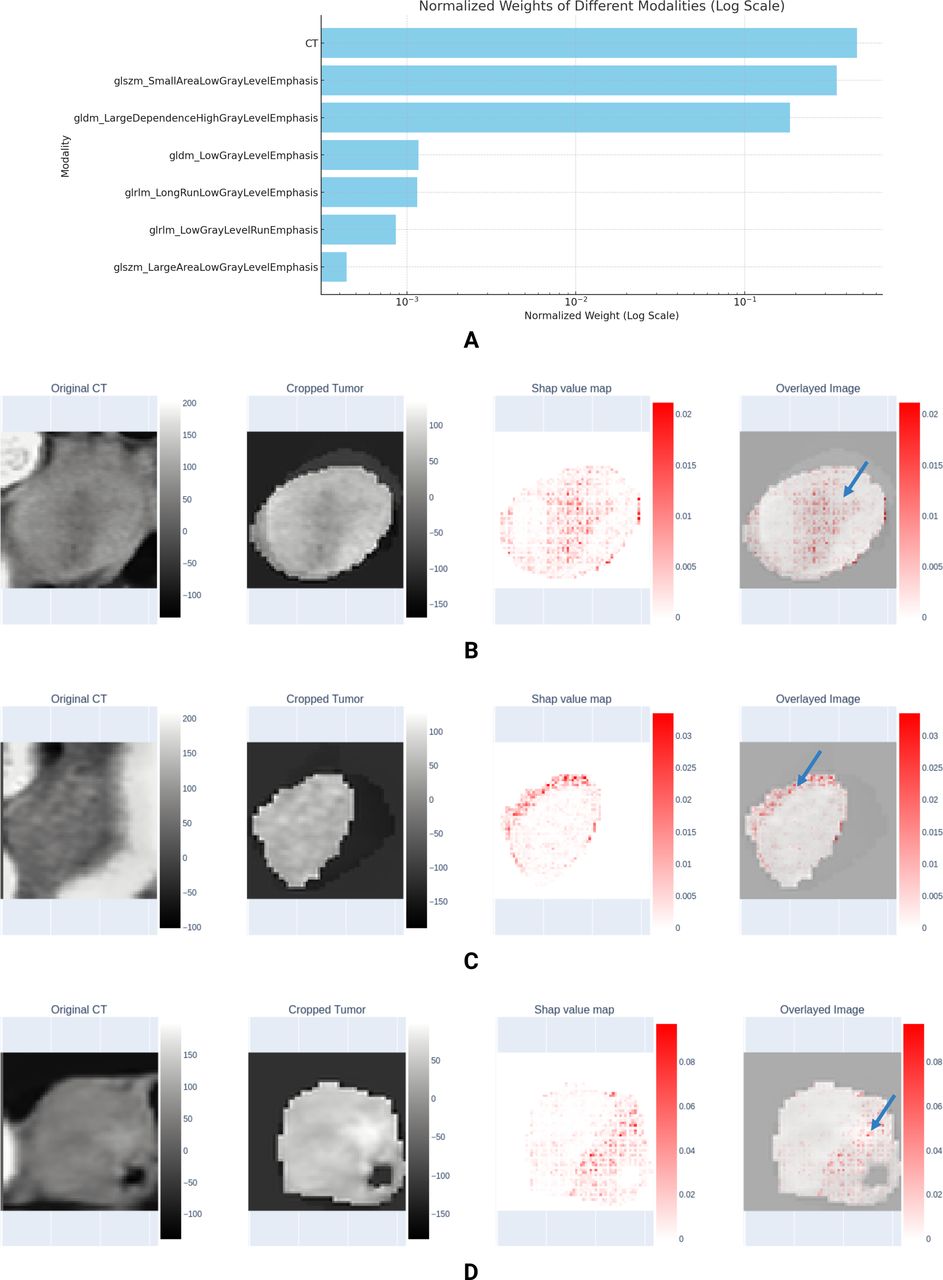 Voxel-level radiomics and deep learning for predicting pathologic ...