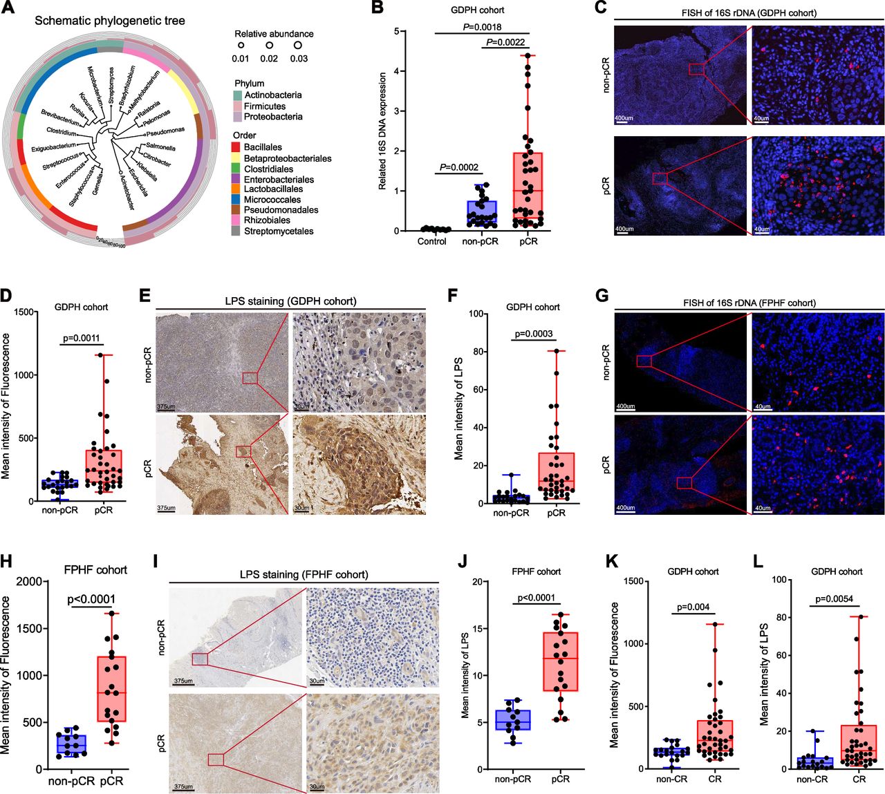 Intratumoral microbiota predicts the response to neoadjuvant