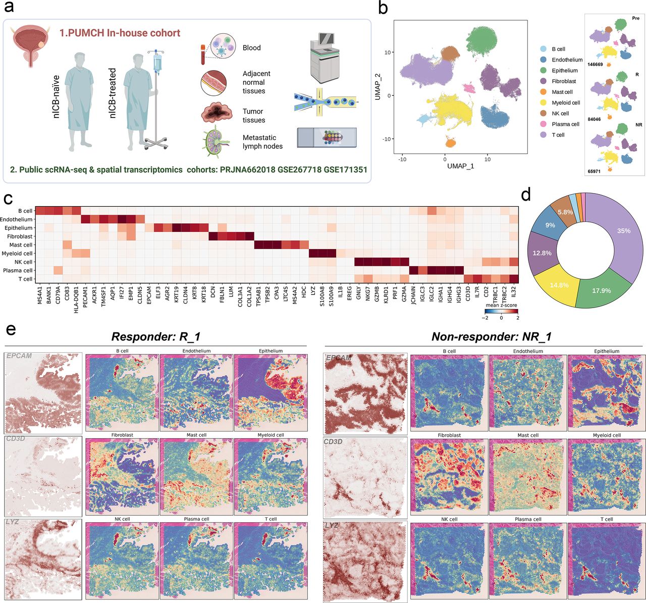 アガベ＊Cancer Malevolent alliance of MYBL2hi cancer stem cell and SPP1+
