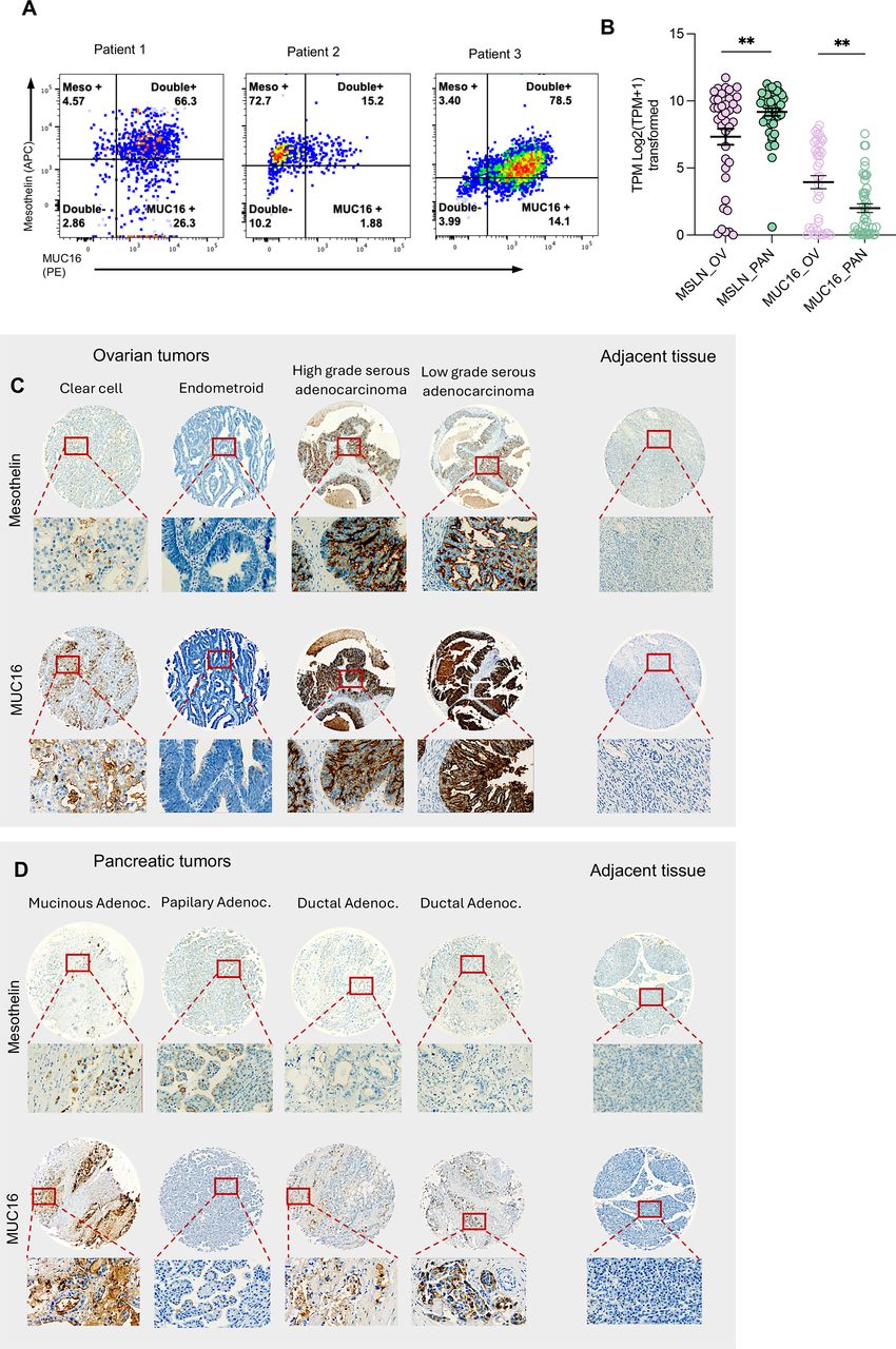 Tandem CAR-T cells targeting mesothelin and MUC16 overcome tumor ...