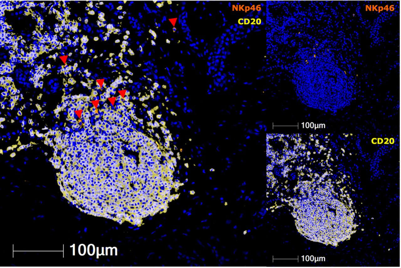 806 Unraveling the spatial distribution and interactions of NK cell ...