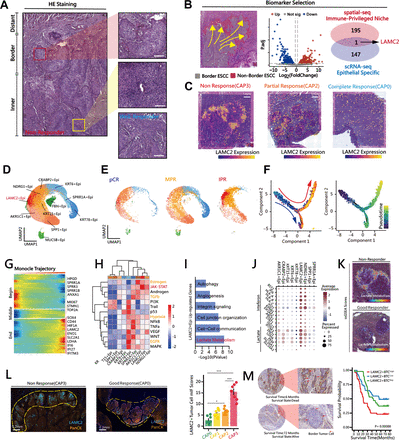 An Immune-privileged niche mediates immunotherapy resistance in