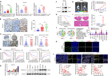 HOXD13-mediated immune crosstalk between cancer cells and tumor