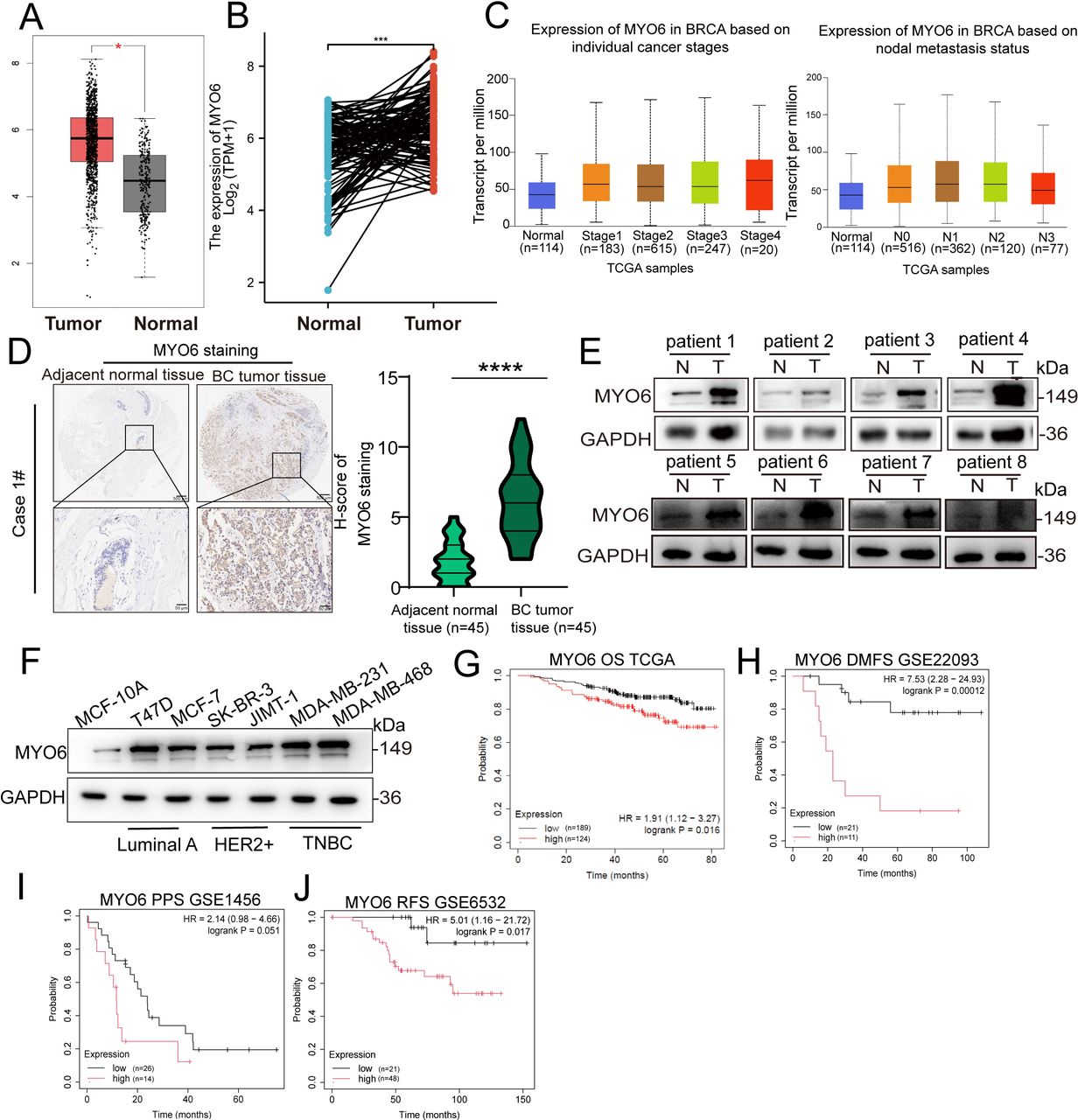 Myosin VI drives breast cancer progression via SP1/CA9-mediated acidic tumor microenvironment remodeling and subsequent M2 macrophage polarization