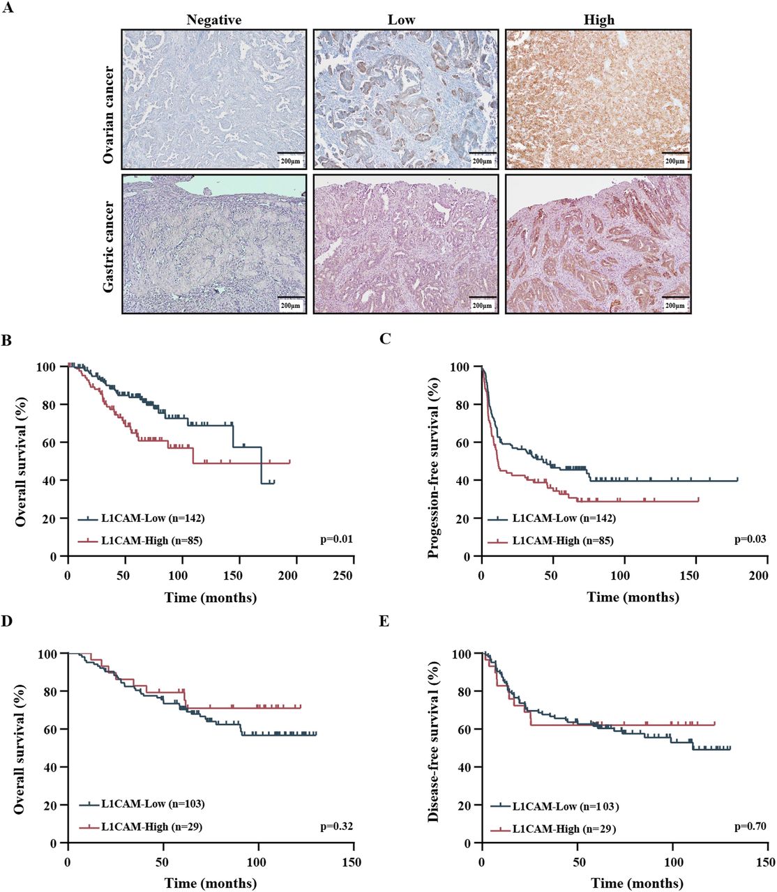 CD28-ICOS costimulation enhances the therapeutic efficacy of L1CAM